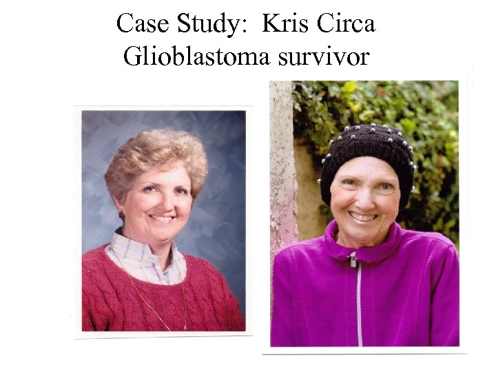Case Study: Kris Circa Glioblastoma survivor 