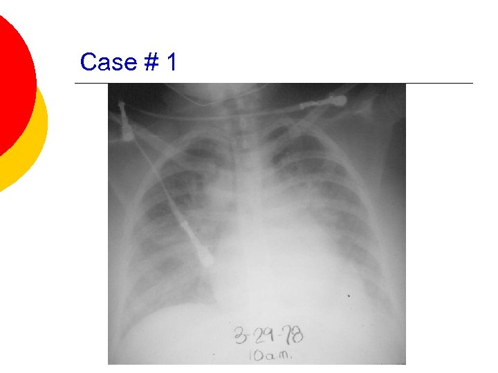 Case # 1 