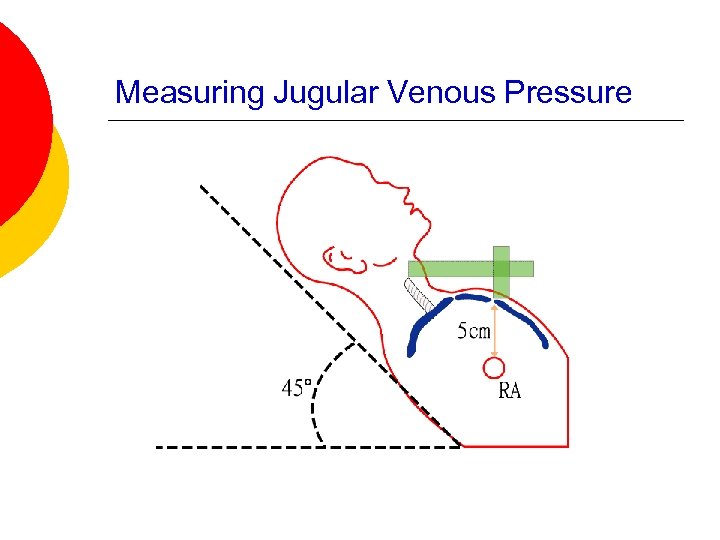 Measuring Jugular Venous Pressure 