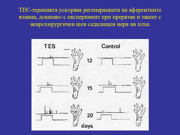 ТЕС-терапията ускорява регенерацията на аферентните влакна, доказано с експеримент при прерязан и зашит с