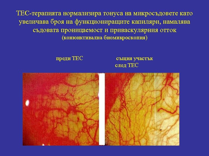 ТЕС-терапията нормализира тонуса на микросъдовете като увеличава броя на функциониращите капиляри, намалява съдовата проницаемост