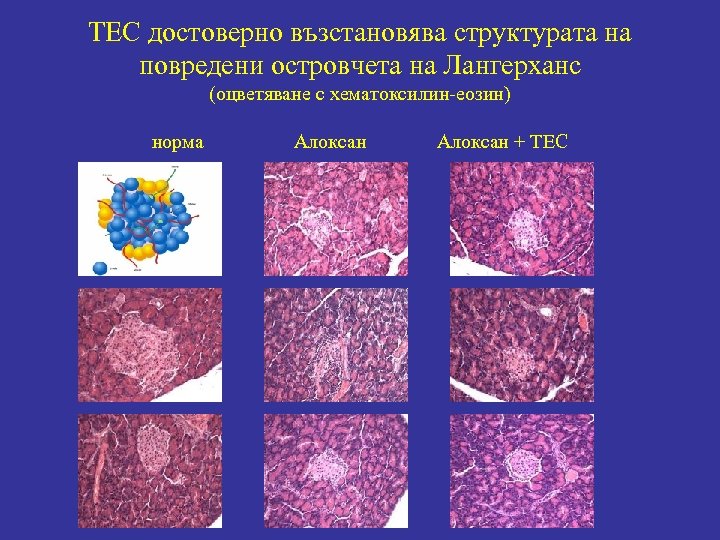 ТЕС достоверно възстановява структурата на повредени островчета на Лангерханс (оцветяване с хематоксилин-еозин) норма Алоксан