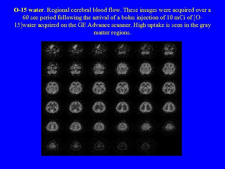O-15 water. Regional cerebral blood flow. These images were acquired over a 60 sec