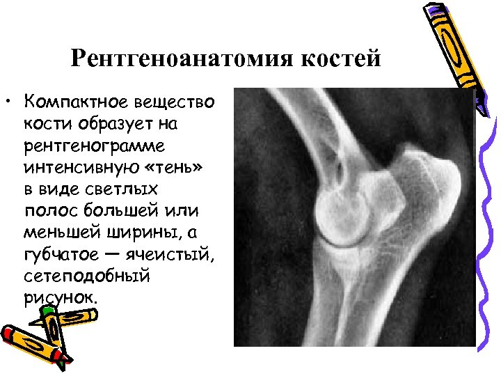 Строение костей в рентгеновском изображении возрастные особенности