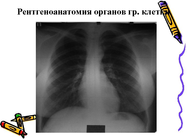 Рентгеноанатомия органов гр. клетки 