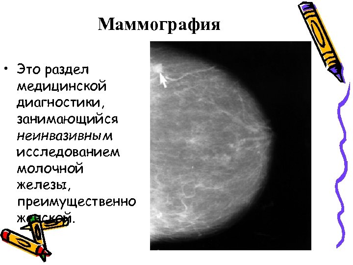 Маммография • Это раздел медицинской диагностики, занимающийся неинвазивным исследованием молочной железы, преимущественно женской. 