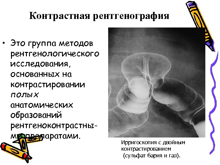 Ирригоскопия это рентгенологическое контрастное исследование