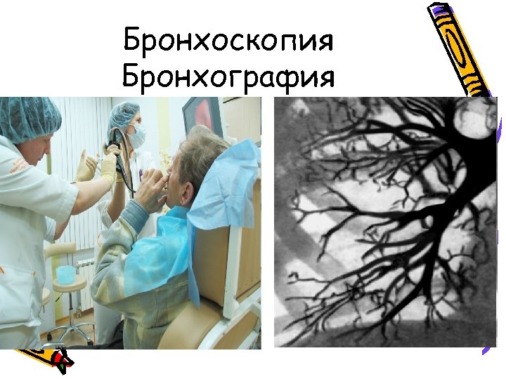 Бронхоскопия Бронхография 