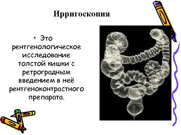 Ирригоскопия • Это рентгенологическое исследование толстой кишки с ретроградным введением в неё рентгеноконтрастного препарата.