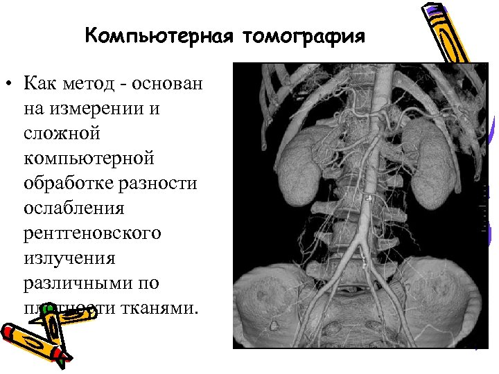 Компьютерная томография • Как метод - основан на измерении и сложной компьютерной обработке разности