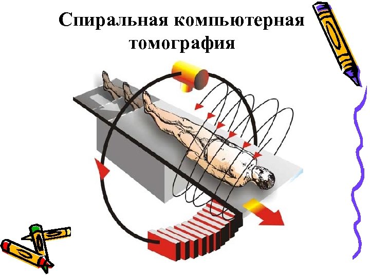 Спиральная компьютерная томография 