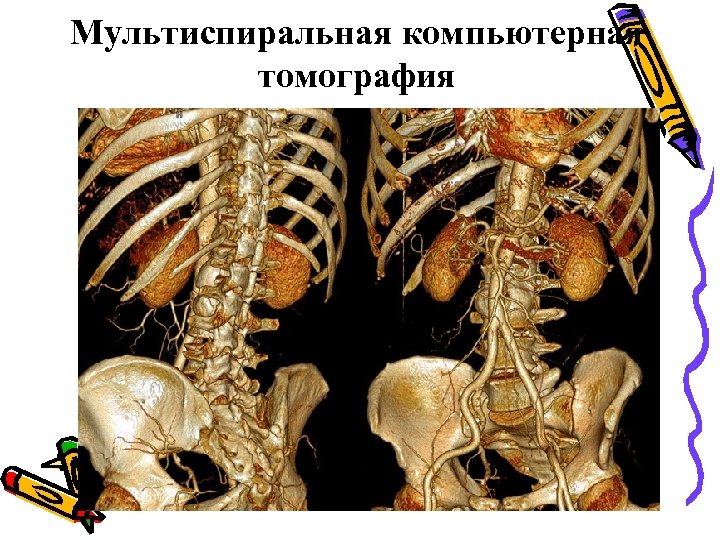 Мультиспиральная компьютерная томография 