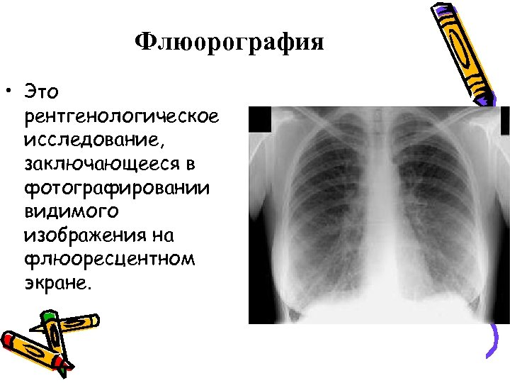 Флюорография • Это рентгенологическое исследование, заключающееся в фотографировании видимого изображения на флюоресцентном экране. 