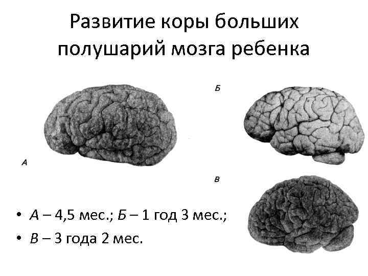 Развитие коры больших полушарий мозга ребенка • А – 4, 5 мес. ; Б