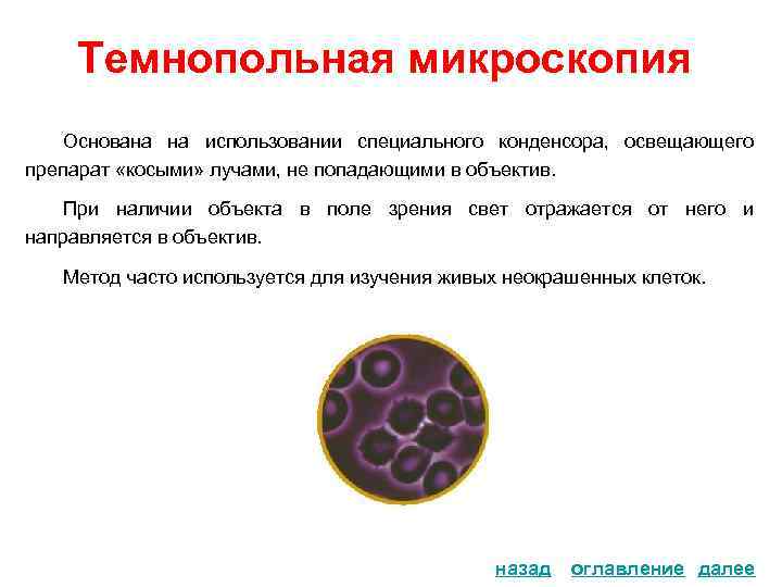 Темнопольная микроскопия Основана на использовании специального конденсора, освещающего препарат «косыми» лучами, не попадающими в