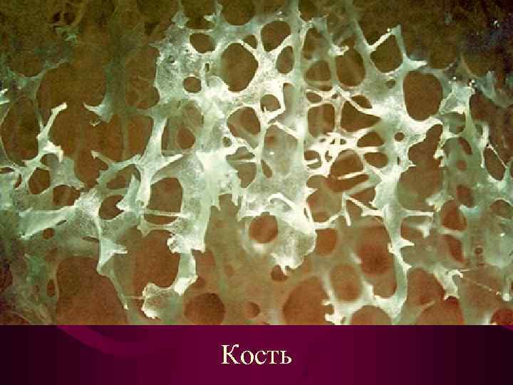 Кость 