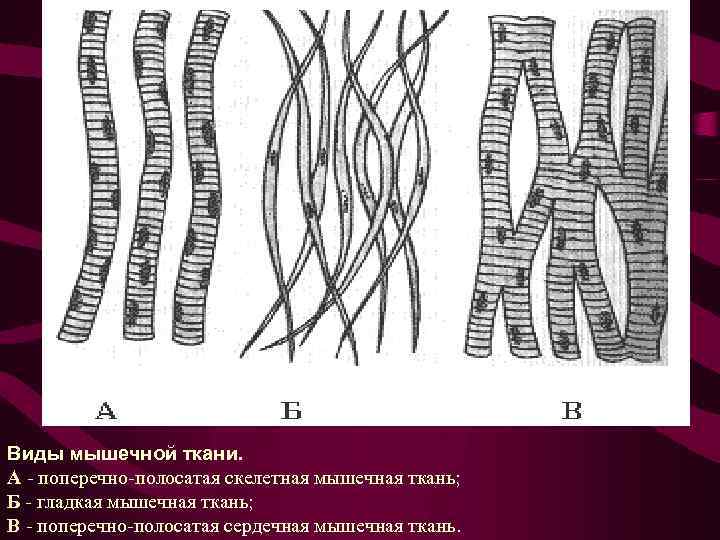 Виды мышечной ткани. А - поперечно-полосатая скелетная мышечная ткань; Б - гладкая мышечная ткань;