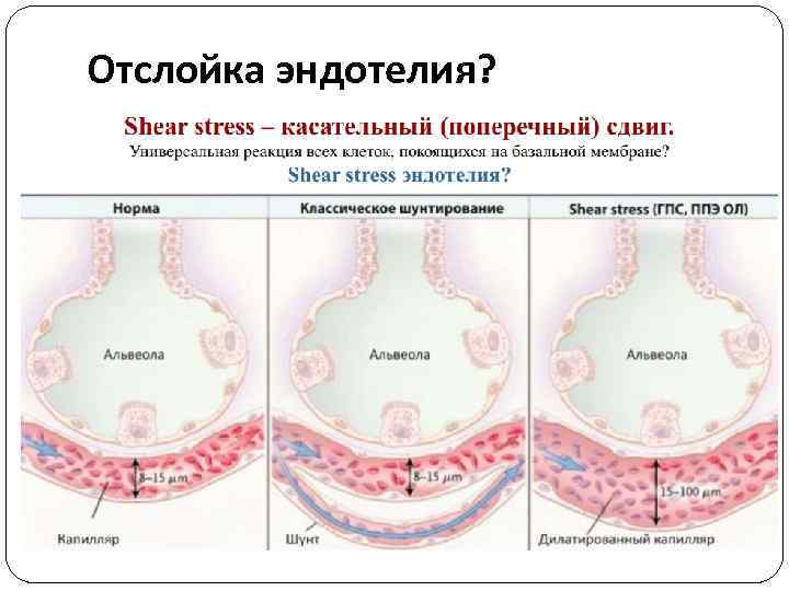 Отслойка эндотелия? 