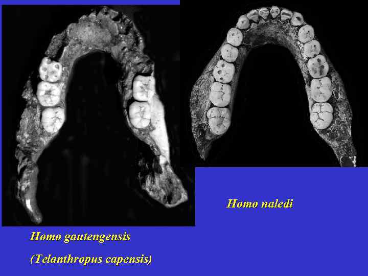 Homo naledi Homo gautengensis (Telanthropus capensis) 