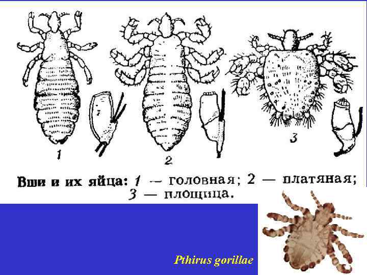 Pthirus gorillae 