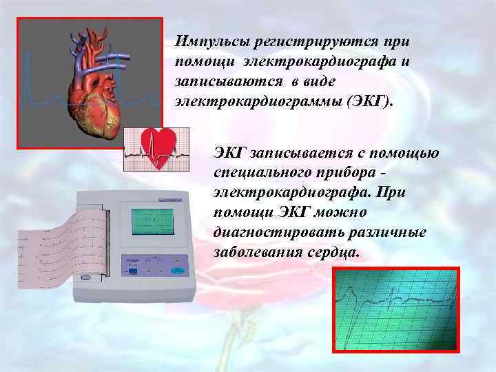 Импульсы регистрируются при помощи электрокардиографа и записываются в виде электрокардиограммы (ЭКГ). ЭКГ записывается с