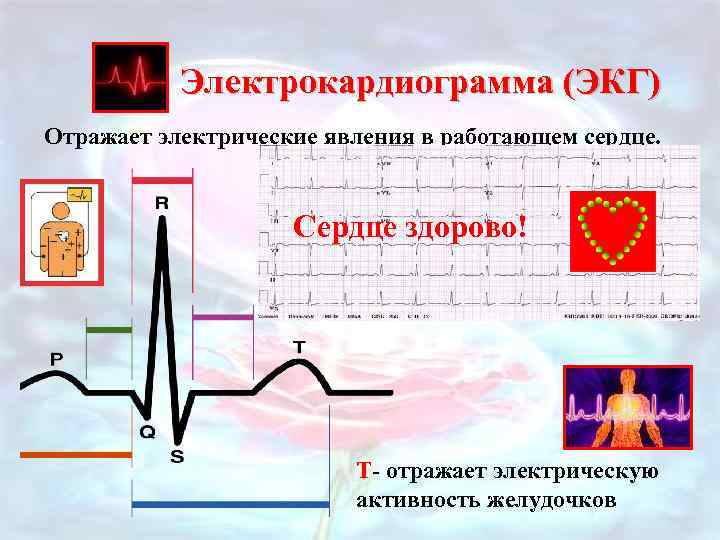 Электрокардиограмма (ЭКГ) Отражает электрические явления в работающем сердце. P- отражает электрическую Сердце здорово! активность