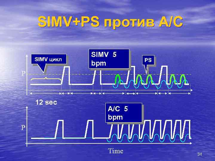 SIMV+PS против A/C SIMV цикл SIMV 5 bpm PS Р 12 sec A/C 5