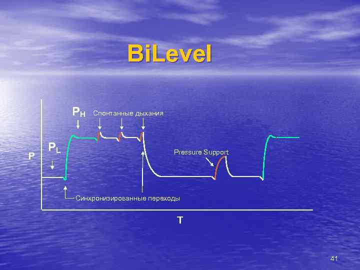 Bi. Level PH P PL Спонтанные дыхания Pressure Support Синхронизированные переходы T 41 