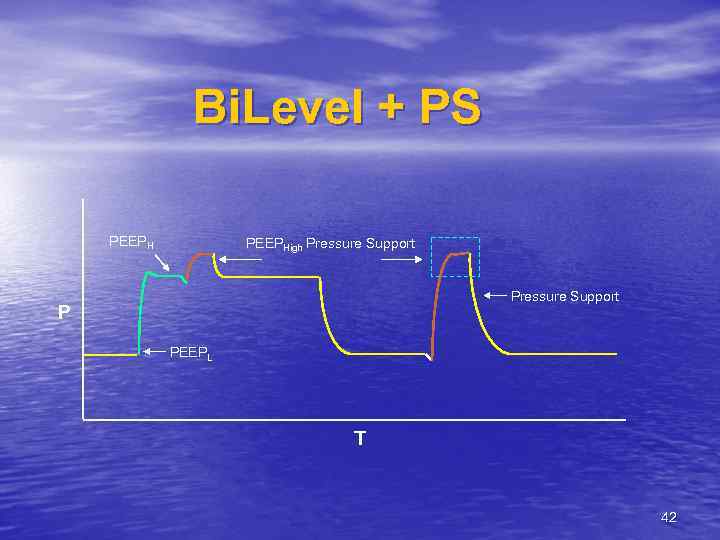 Bi. Level + PS PEEPHigh Pressure Support P PEEPL T 42 