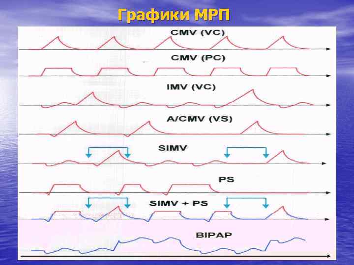 Графики МРП 46 