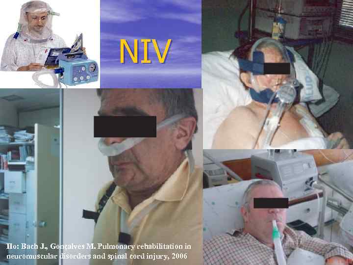 NIV По: Bach J. , Gonçalves M. Pulmonary rehabilitation in neuromuscular disorders and spinal