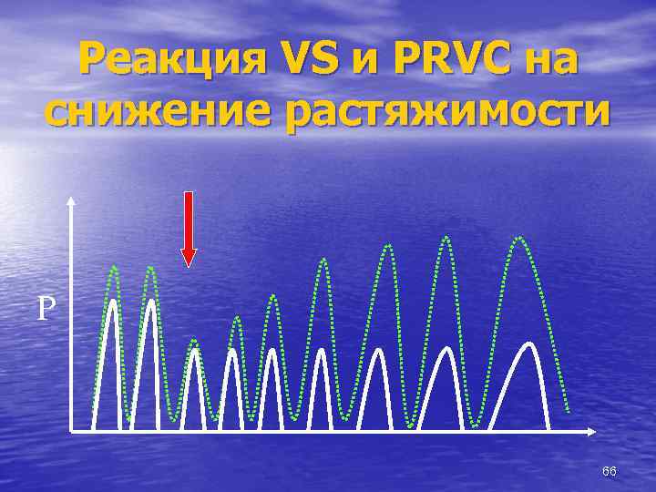 Реакция VS и PRVС на снижение растяжимости P 66 