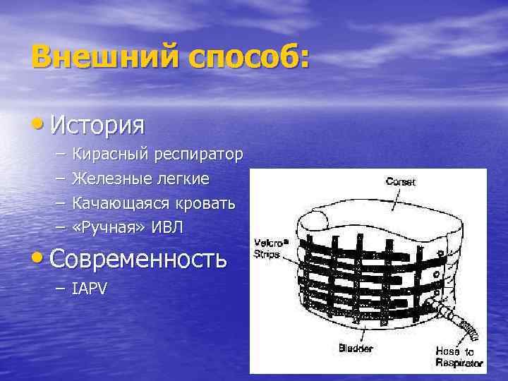 Внешний способ: • История – – Кирасный респиратор Железные легкие Качающаяся кровать «Ручная» ИВЛ