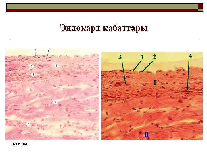 Эндокард қабаттары 17. 02. 2018 