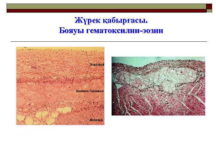 Жүрек қабырғасы. Бояуы гематоксилин-эозин 