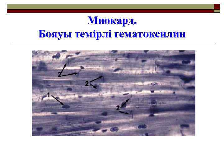 Миокард. Бояуы темірлі гематоксилин 