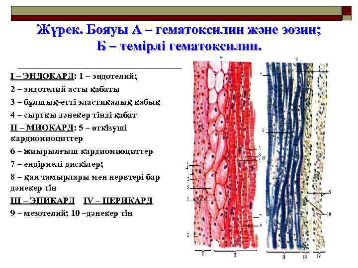 Жүрек. Бояуы А – гематоксилин және эозин; Б – темірлі гематоксилин. I – ЭНДОКАРД: