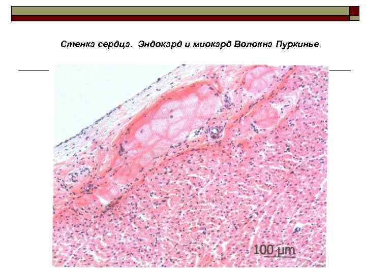 Стенка сердца. Эндокард и миокард Волокна Пуркинье 