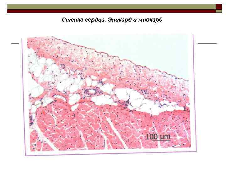 Стенка сердца. Эпикард и миокард 