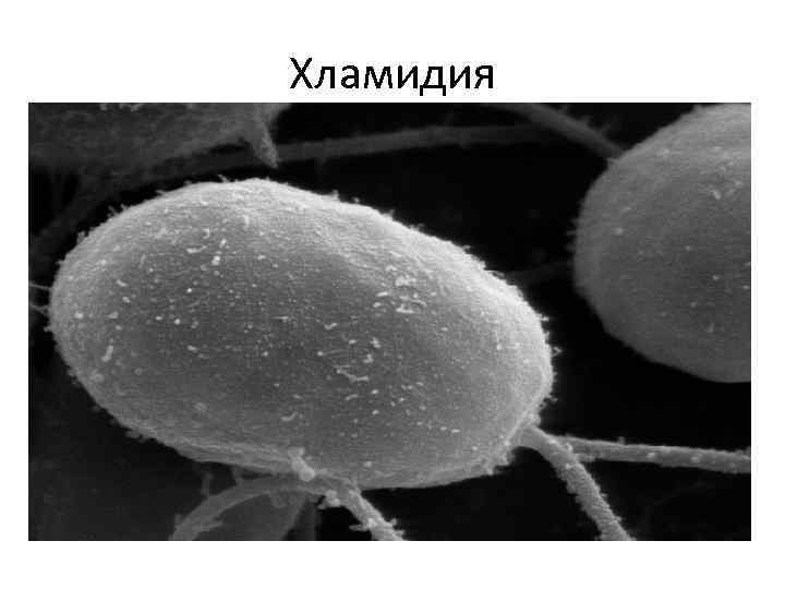 Хламидия 