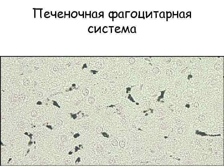 Печеночная фагоцитарная система 