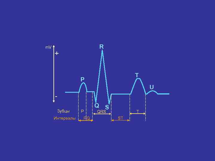 m. V R + T P U Зубцы Интервалы Q P PQ S T