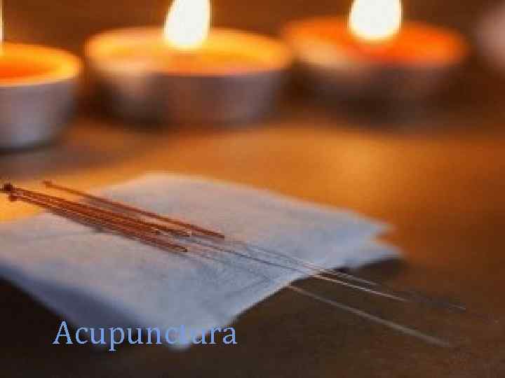 Acupunctura 