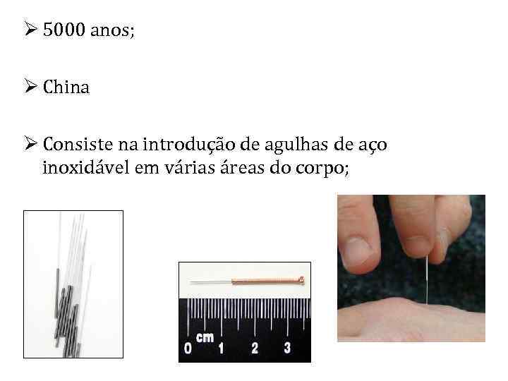 Ø 5000 anos; Ø China Ø Consiste na introdução de agulhas de aço inoxidável