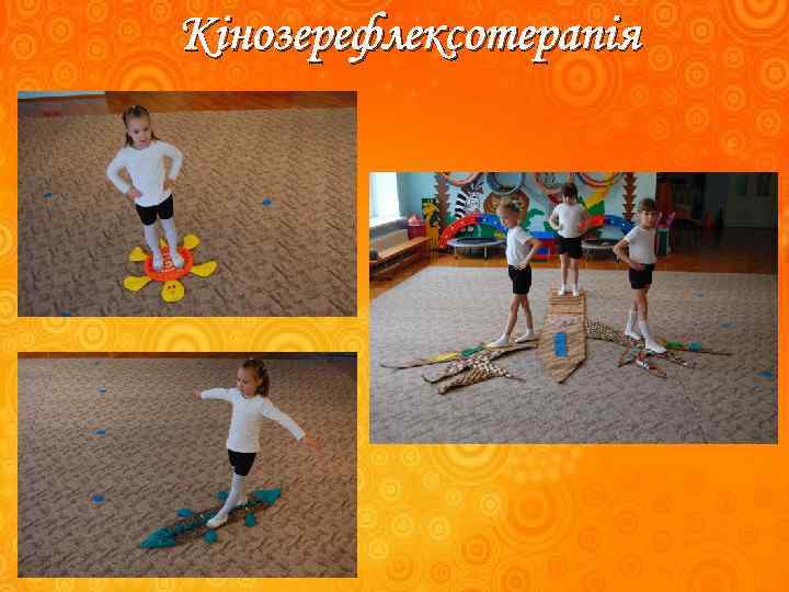 Кінозерефлексотерапія 