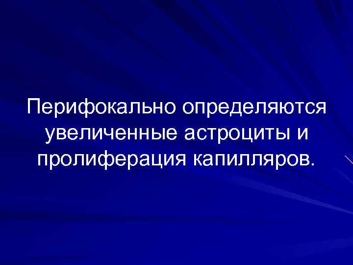 Перифокально определяются увеличенные астроциты и пролиферация капилляров. 