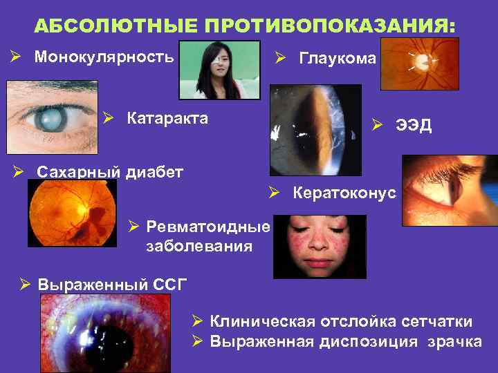 АБСОЛЮТНЫЕ ПРОТИВОПОКАЗАНИЯ: Ø Монокулярность Ø Глаукома Ø Катаракта Ø ЭЭД Ø Сахарный диабет Ø