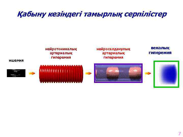 Қабыну кезіндегі тамырлық серпілістер ишемия нейротоникалық артериалық гиперемия нейросалданулық артериалық гиперемия веналық гиперемия 7