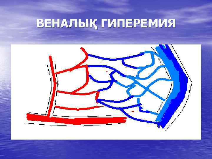 ВЕНАЛЫҚ ГИПЕРЕМИЯ 