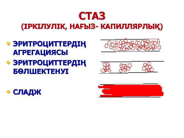 СТАЗ (ІРКІЛУЛІК, НАҒЫЗ- КАПИЛЛЯРЛЫҚ) • ЭРИТРОЦИТТЕРДІҢ • АГРЕГАЦИЯСЫ ЭРИТРОЦИТТЕРДІҢ БӨЛШЕКТЕНУІ • СЛАДЖ 